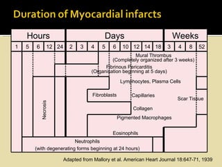 Hours                                   Days                            Weeks
1   5   6         12 24     2    3    4    5    6     10 12 14 18       3    4   8    52
                                                         Mural Thrombus
                                               (Completely organized after 3 weeks)
                                            Fibrinous Pericarditis
                                      (Organisation beginning at 5 days)

                                                     Lymphocytes, Plasma Cells

                                      Fibroblasts        Capillaries
                                                                             Scar Tissue
            Necrosis




                                                          Collagen
                                                    Pigmented Macrophages


                                               Eosinophils
                          Neutrophils
        (with degenerating forms beginning at 24 hours)

                          Adapted from Mallory et al. American Heart Journal 18:647-71, 1939
 