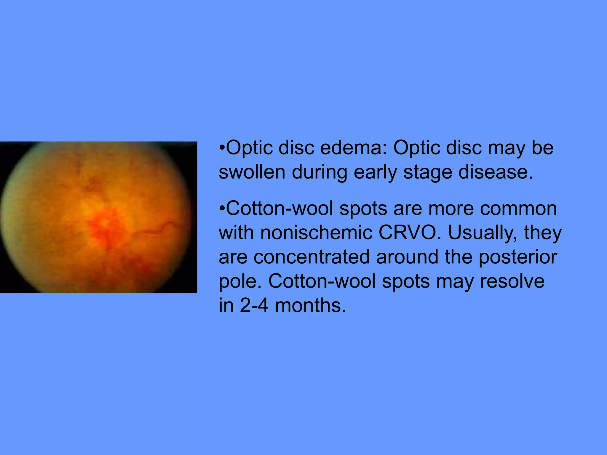 Sudden loss of vision IN A PATIENT ACUTELY | PPT