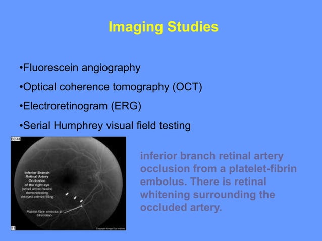 Sudden loss of vision IN A PATIENT ACUTELY | PPT