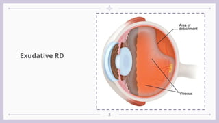 Sudden loss of vision................... | PPTX