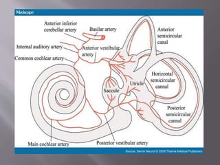 Sudden Sensorineural Hearing Loss | PPTX