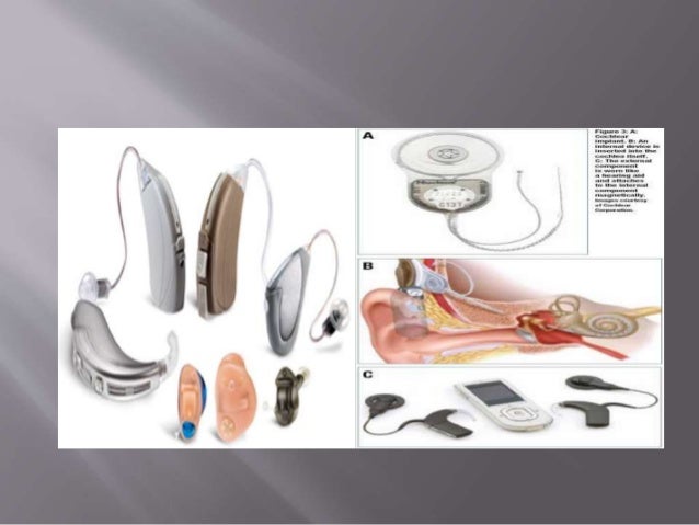 Perilymphatic fistula and lasix treatment