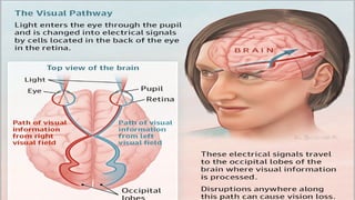 Sudden Visual Loss | PDF