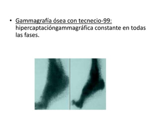 • Gammagrafía ósea con tecnecio-99:
  hipercaptacióngammagráfica constante en todas
  las fases.
 
