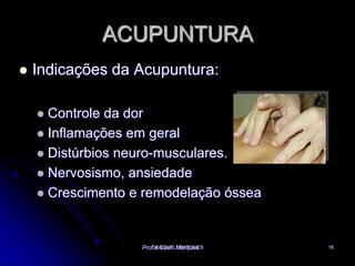 DRA SUELI MARQUES16ACUPUNTURAIndicações da Acupuntura:Controle da dorInflamações em geralDistúrbios neuro-musculares.Nervosismo, ansiedadeCrescimento e remodelação ósseaProf a Sueli  Marques