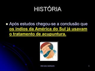 DRA SUELI MARQUES4HISTÓRIAApós estudos chegou-se a conclusão que os índios da América do Sul já usavam o tratamento de acupuntura.
