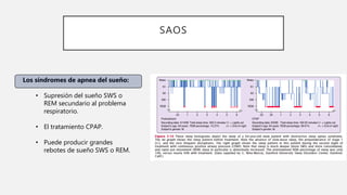 SAOS
Los síndromes de apnea del sueño:
• Supresión del sueño SWS o
REM secundario al problema
respiratorio.
• El tratamiento CPAP.
• Puede producir grandes
rebotes de sueño SWS o REM.
 
