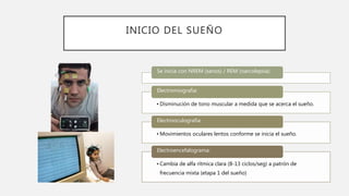 INICIO DEL SUEÑO
Se inicia con NREM (sanos) / REM (narcolepsia)
• Disminución de tono muscular a medida que se acerca el sueño.
Electromiografia:
• Movimientos oculares lentos conforme se inicia el sueño.
Electrooculografia:
• Cambia de alfa rítmica clara (8-13 ciclos/seg) a patrón de
frecuencia mixta (etapa 1 del sueño)
Electroencefalograma:
 