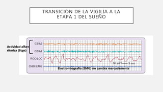 TRANSICIÓN DE LA VIGILIA A LA
ETAPA 1 DEL SUEÑO
Actividad alfa
rítmica (8cps)
Electromiografía (EMG) no cambia marcadamente
 