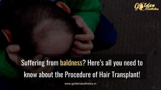 Suffering from baldness? Here’s all you need to
know about the Procedure of Hair Transplant!
www.goldenaesthetics.in
 