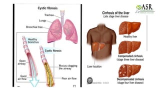 Suffix Osis And Suffix Pexy[Roll.no 75].pptx