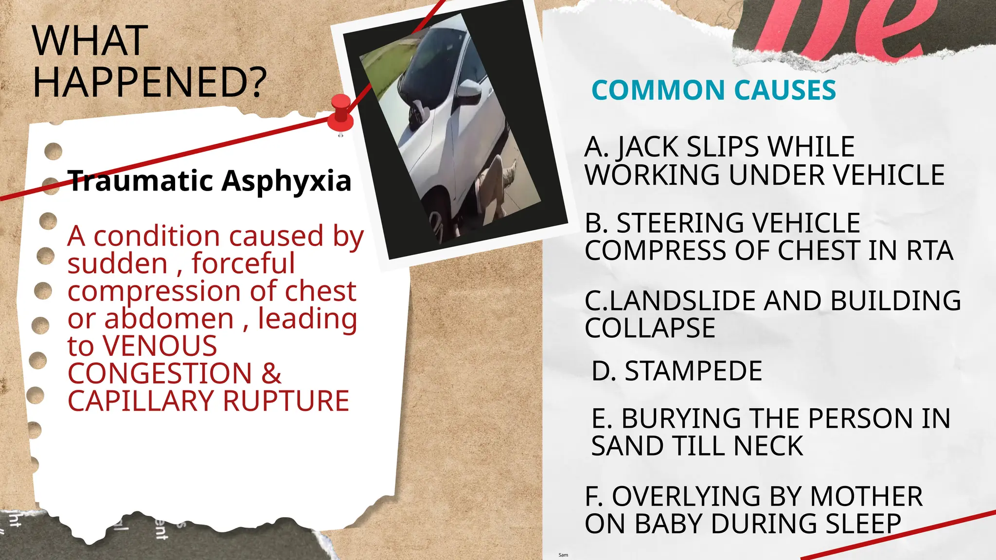 WHAT
HAPPENED?
Traumatic Asphyxia
A condition caused by
sudden , forceful
compression of chest
or abdomen , leading
to VENOUS
CONGESTION &
CAPILLARY RUPTURE
COMMON CAUSES
A. JACK SLIPS WHILE
WORKING UNDER VEHICLE
B. STEERING VEHICLE
COMPRESS OF CHEST IN RTA
C.LANDSLIDE AND BUILDING
COLLAPSE
D. STAMPEDE
F. OVERLYING BY MOTHER
ON BABY DURING SLEEP
E. BURYING THE PERSON IN
SAND TILL NECK
Sam
 