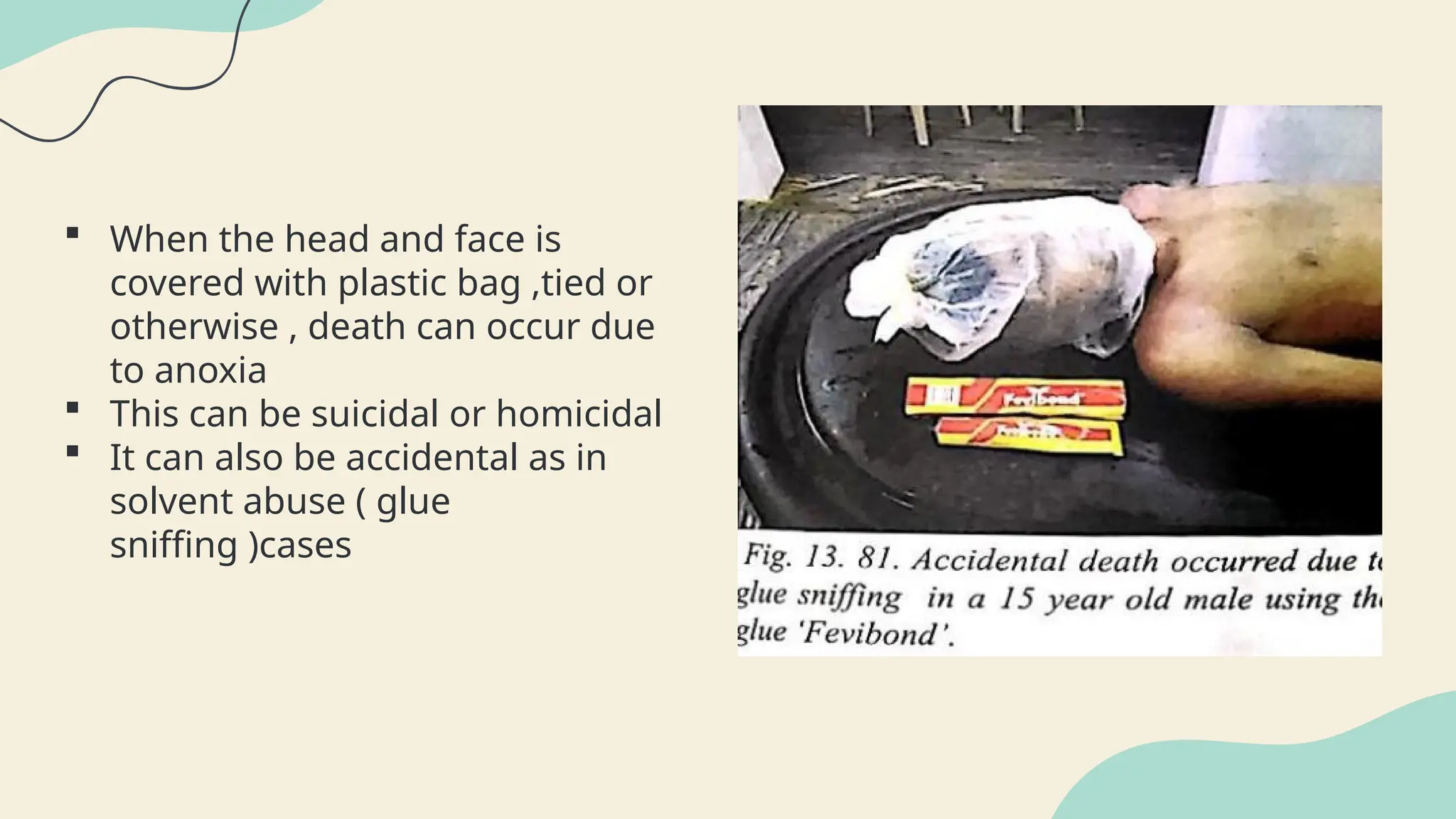  When the head and face is
covered with plastic bag ,tied or
otherwise , death can occur due
to anoxia
 This can be suicidal or homicidal
 It can also be accidental as in
solvent abuse ( glue
sniffing )cases
 