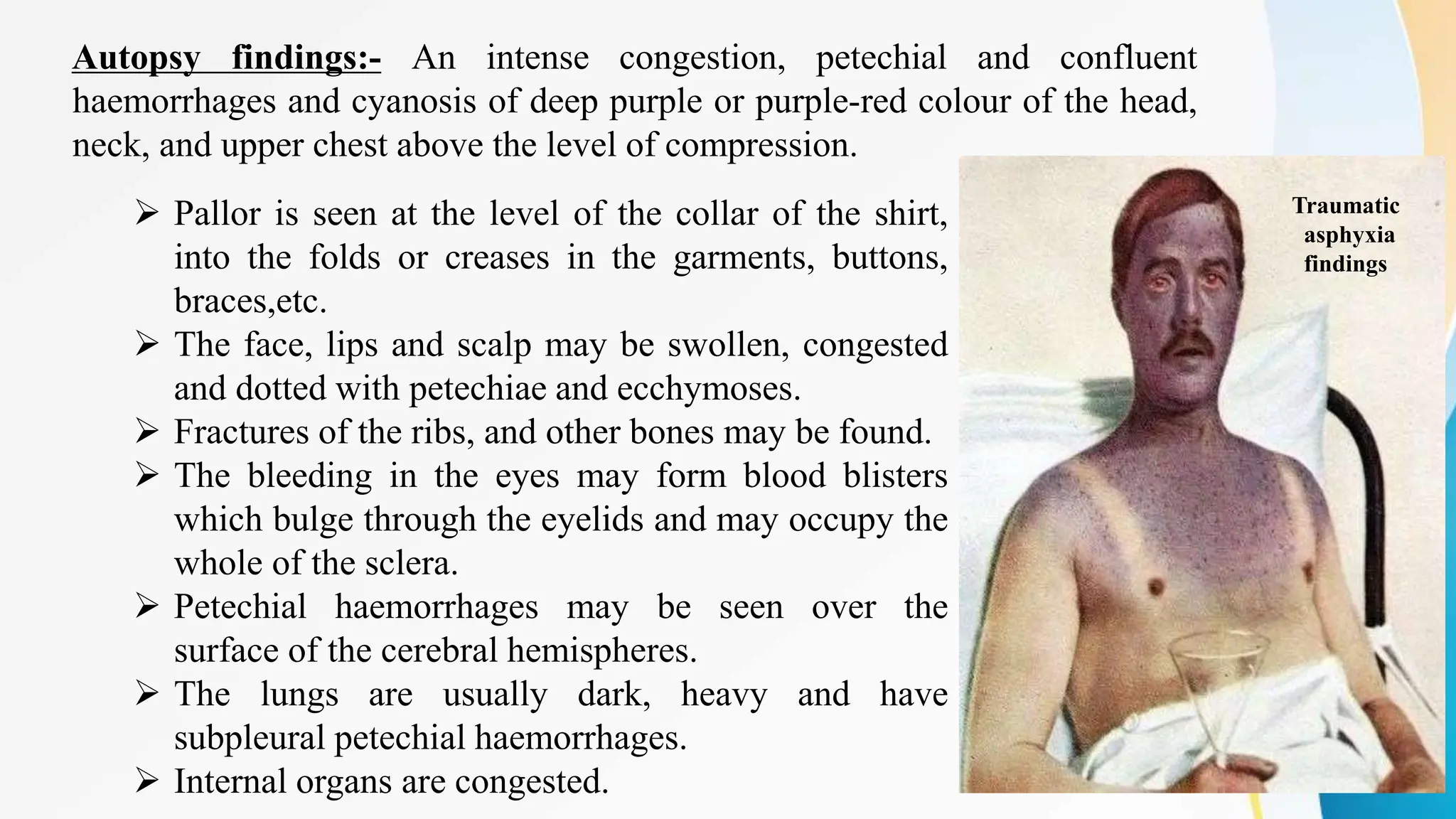 Autopsy findings:- An intense congestion, petechial and confluent
haemorrhages and cyanosis of deep purple or purple-red colour of the head,
neck, and upper chest above the level of compression.
 Pallor is seen at the level of the collar of the shirt,
into the folds or creases in the garments, buttons,
braces,etc.
 The face, lips and scalp may be swollen, congested
and dotted with petechiae and ecchymoses.
 Fractures of the ribs, and other bones may be found.
 The bleeding in the eyes may form blood blisters
which bulge through the eyelids and may occupy the
whole of the sclera.
 Petechial haemorrhages may be seen over the
surface of the cerebral hemispheres.
 The lungs are usually dark, heavy and have
subpleural petechial haemorrhages.
 Internal organs are congested.
Traumatic
asphyxia
findings
 