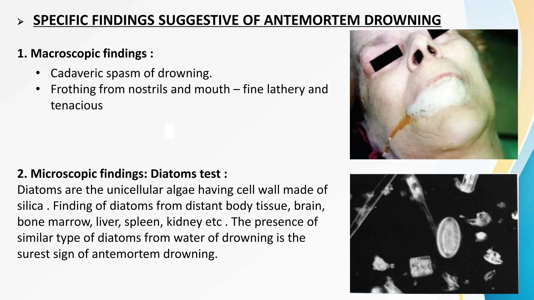 SPECIFIC FINDINGS SUGGESTIVE OF ANTEMORTEM DROWNING
1. Macroscopic findings :
2. Microscopic findings: Diatoms test :
Diatoms are the unicellular algae having cell wall made of
silica . Finding of diatoms from distant body tissue, brain,
bone marrow, liver, spleen, kidney etc . The presence of
similar type of diatoms from water of drowning is the
surest sign of antemortem drowning.
• Cadaveric spasm of drowning.
• Frothing from nostrils and mouth – fine lathery and
tenacious
 