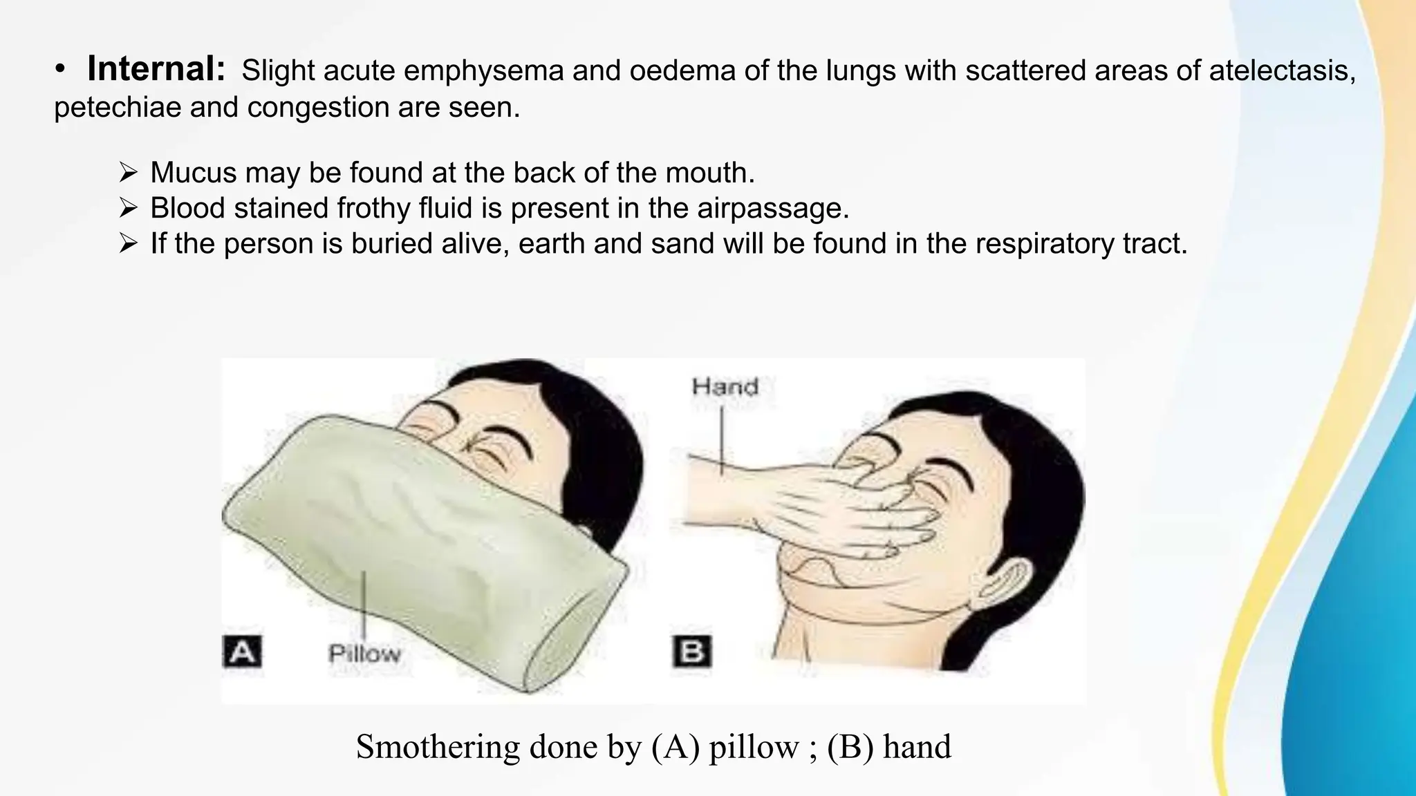 • Internal: Slight acute emphysema and oedema of the lungs with scattered areas of atelectasis,
petechiae and congestion are seen.
 Mucus may be found at the back of the mouth.
 Blood stained frothy fluid is present in the airpassage.
 If the person is buried alive, earth and sand will be found in the respiratory tract.
Smothering done by (A) pillow ; (B) hand
 