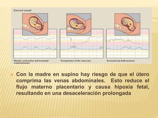   Con la madre en supino hay riesgo de que el útero
    comprima las venas abdominales. Esto reduce el
    flujo materno placentario y causa hipoxia fetal,
    resultando en una desaceleración prolongada
 