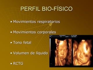 PERFIL BIO-FÍSICO
• Movimientos respiratorios
• Movimientos corporales
• Tono fetal
• Volumen de líquido
• RCTG
 