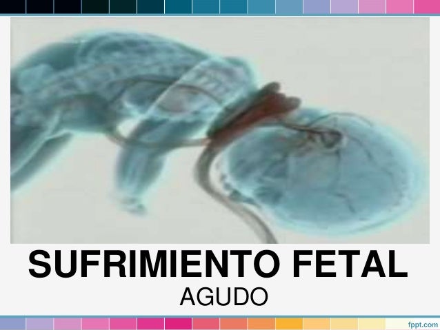Resultado de imagen para sufrimiento fetal