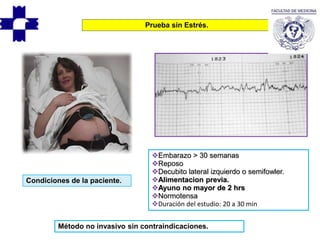 Condiciones de la paciente.
Prueba sin Estrés.
Embarazo > 30 semanas
Reposo
Decubito lateral izquierdo o semifowler.
Alimentacion previa.
Ayuno no mayor de 2 hrs
Normotensa
Duración del estudio: 20 a 30 min
Método no invasivo sin contraindicaciones.
 