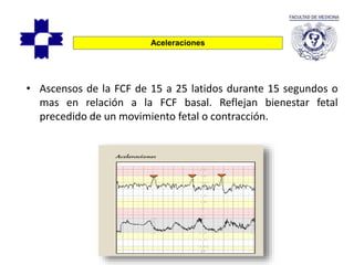 • Ascensos de la FCF de 15 a 25 latidos durante 15 segundos o
mas en relación a la FCF basal. Reflejan bienestar fetal
precedido de un movimiento fetal o contracción.
Aceleraciones
 