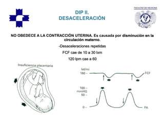 DIP II.
DESACELERACIÓN
NO OBEDECE A LA CONTRACCIÓN UTERINA. Es causada por disminución en la
circulación materno.
-Desaceleraciones repetidas
FCF cae de 10 a 30 lxm
120 lpm cae a 60
 
