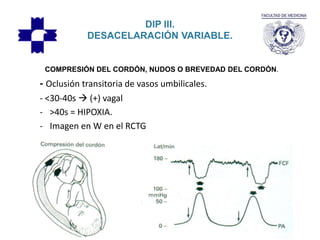 DIP III.
DESACELARACIÓN VARIABLE.
- Oclusión transitoria de vasos umbilicales.
- <30-40s  (+) vagal
- >40s = HIPOXIA.
- Imagen en W en el RCTG
COMPRESIÓN DEL CORDÓN, NUDOS O BREVEDAD DEL CORDÓN.
 