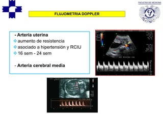 FLUJOMETRIA DOPPLER
- Arteria uterina
aumento de resistencia
asociado a hipertensión y RCIU
16 sem - 24 sem
- Arteria cerebral media
 