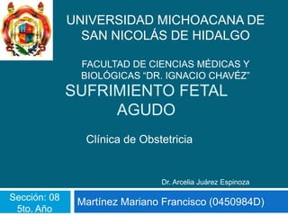 UNIVERSIDAD MICHOACANA DE
                SAN NICOLÁS DE HIDALGO

               FACULTAD DE CIENCIAS MÉDICAS Y
               BIOLÓGICAS “DR. IGNACIO CHAVÉZ”
              SUFRIMIENTO FETAL
                   AGUDO
                Clínica de Obstetricia


                               Dr. Arcelia Juárez Espinoza

Sección: 08    Martínez Mariano Francisco (0450984D)
 5to. Año
 