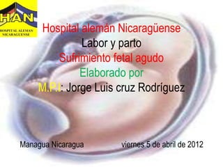 Hospital alemán Nicaragüense
              Labor y parto
         Sufrimiento fetal agudo
              Elaborado por
    M.P.I: Jorge Luis cruz Rodríguez



Managua Nicaragua     viernes 5 de abril de 2012
 