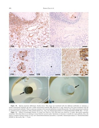 Figure 10. Species reactivity differences. Eyelid, horse. This tissue was incubated with two different antibodies to vimentin, a
mouse monoclonal antibody (A) and a rabbit monoclonal antibody (B). Reactivity is only observed in the tissue incubated with the
mouse monoclonal antibody. There is spurious staining in the mucosal epithelium in panel B (asterisk). The rabbit monoclonal antibody
to vimentin reacts as expected in other animal species (e.g., dog, cat). Immunoperoxidase-3,39-diaminobenzidine (DAB). Bar 5 65 mm.
Figure 11. Effects of prolonged fixation. A, tissue was fixed for 24 hr. B, tissue was fixed for 11 weeks. Bartonella organisms
(asterisks). Note that there is no staining in tissue fixed for several weeks. Sensitivity to fixation is variable for each antibody; thus, the
need to evaluate fixation kinetics in any new immunohistochemical procedure, if possible. Immunoperoxidase-3,39-diaminobenzidine
(DAB) for Bartonella. Bar 5 33 mm.
404 Ramos-Vara et al.
 