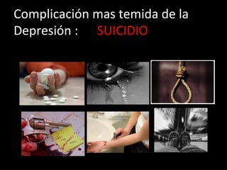 Complicación mas temida de la
Depresión : SUICIDIO

 