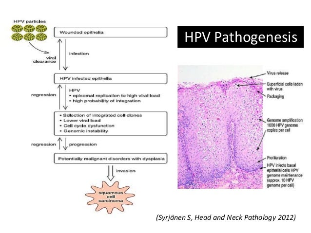 Pathogenesis Of Hpv – Molecular pathways in the development of HPV ...