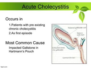 Acute Cholecystitis
Occurs in
1.Patients with pre existing
chronic cholecystitis
2.As first episode
Most Common Cause
Impacted Gallstone in
Hartmann’s Pouch
 