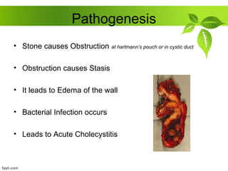 Pathogenesis
• Stone causes Obstruction at hartmann’s pouch or in cystic duct
• Obstruction causes Stasis
• It leads to Edema of the wall
• Bacterial Infection occurs
• Leads to Acute Cholecystitis
 