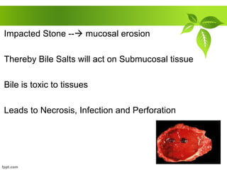 Impacted Stone -- mucosal erosion
Thereby Bile Salts will act on Submucosal tissue
Bile is toxic to tissues
Leads to Necrosis, Infection and Perforation
 