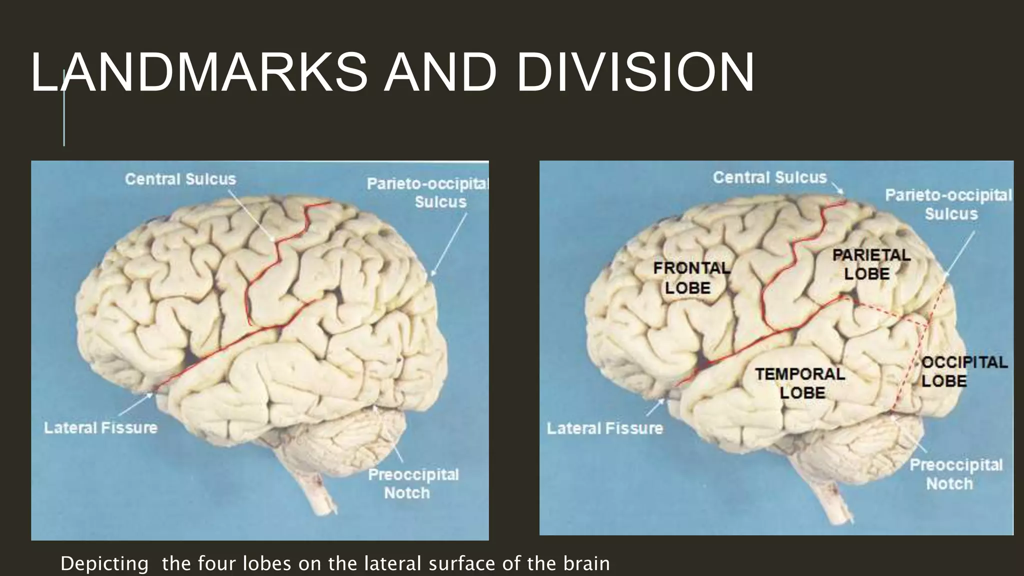 central-fissure-separates-which-lobes