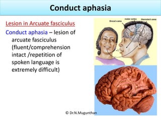 SULCI, GYRI & FUNCTIONAL AREAS OF CEREBRUM-Prof.Dr.N.Mugunthan KMMC.pdf