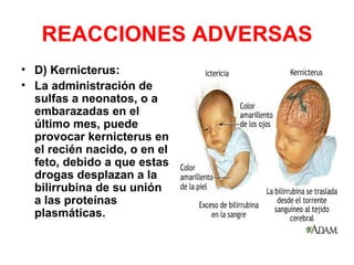 REACCIONES ADVERSAS
• D) Kernicterus:
• La administración de
  sulfas a neonatos, o a
  embarazadas en el
  último mes, puede
  provocar kernicterus en
  el recién nacido, o en el
  feto, debido a que estas
  drogas desplazan a la
  bilirrubina de su unión
  a las proteínas
  plasmáticas.
 
