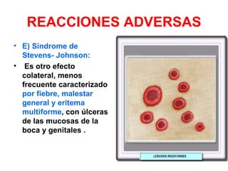 REACCIONES ADVERSAS
• E) Síndrome de
  Stevens- Johnson:
• Es otro efecto
  colateral, menos
  frecuente caracterizado
  por fiebre, malestar
  general y eritema
  multiforme, con úlceras
  de las mucosas de la
  boca y genitales .
 