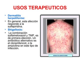 USOS TERAPEUTICOS
• Dermatitis
herpetiforme:
• En general, esta afección
responde a la
sulfapiridina.
• Shigellosis:
• La combinación
sulfametoxazol y TMP, es
de primera elección. Un
antibiótico alternativo es
el cloramfenicol, o la
ampicilina en este tipo de
infección.
 