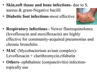 • Skin,soft tissue and bone infections- due to S.
aureus & gram-Negative bacilli
• Diabetic foot infections-most effective
• Respiratory infections:- Newer fluoroquinolones
(levofloxacin and moxifloxacin) are highly
effective for community-acquired pneumonias and
chronic bronchitis
• MAC (Mycobacterium avium complex)-
Levofloxacin + clarithromycin,rifabutin
• Others- ophthalmic (conjunctivitis) infection-
topically use
 