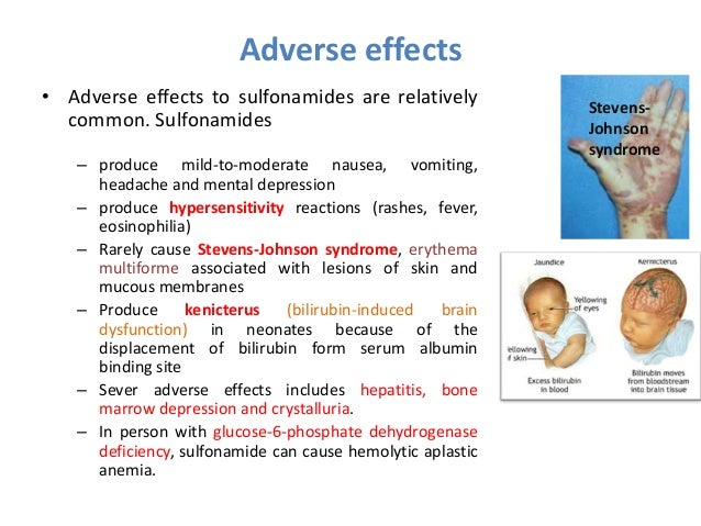 Side effects to sulfa drugs