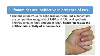 Sulphonamides and sulfa drugs