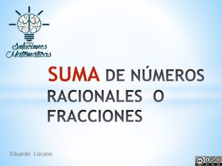 SUMA
Eduardo Lizcano
 