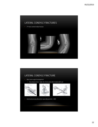 Jacob Classification Common Fractures Of Upper Limb | PDF