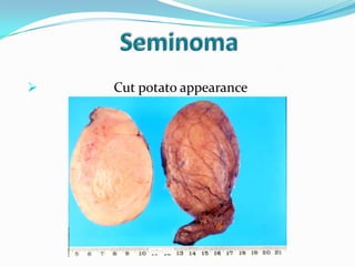  Cut potato appearance
 