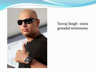 Yuvraj Singh –extra
gonadal seminoma
 