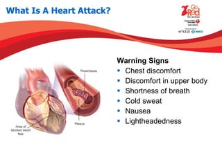 What Is A Heart Attack? Warning Signs Chest discomfort Discomfort in upper body Shortness of breath Cold sweat Nausea Lightheadedness 