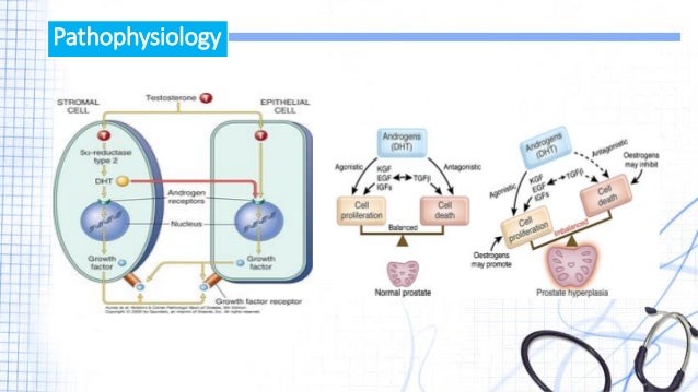 Benign Prostatic hyperplasia electrolyte lab diagram 